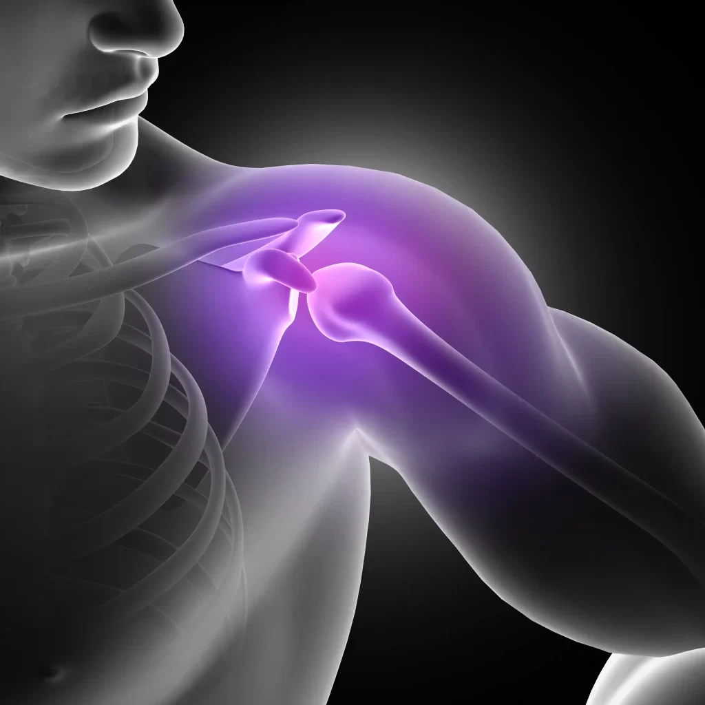 Shoulder Arthroscopy